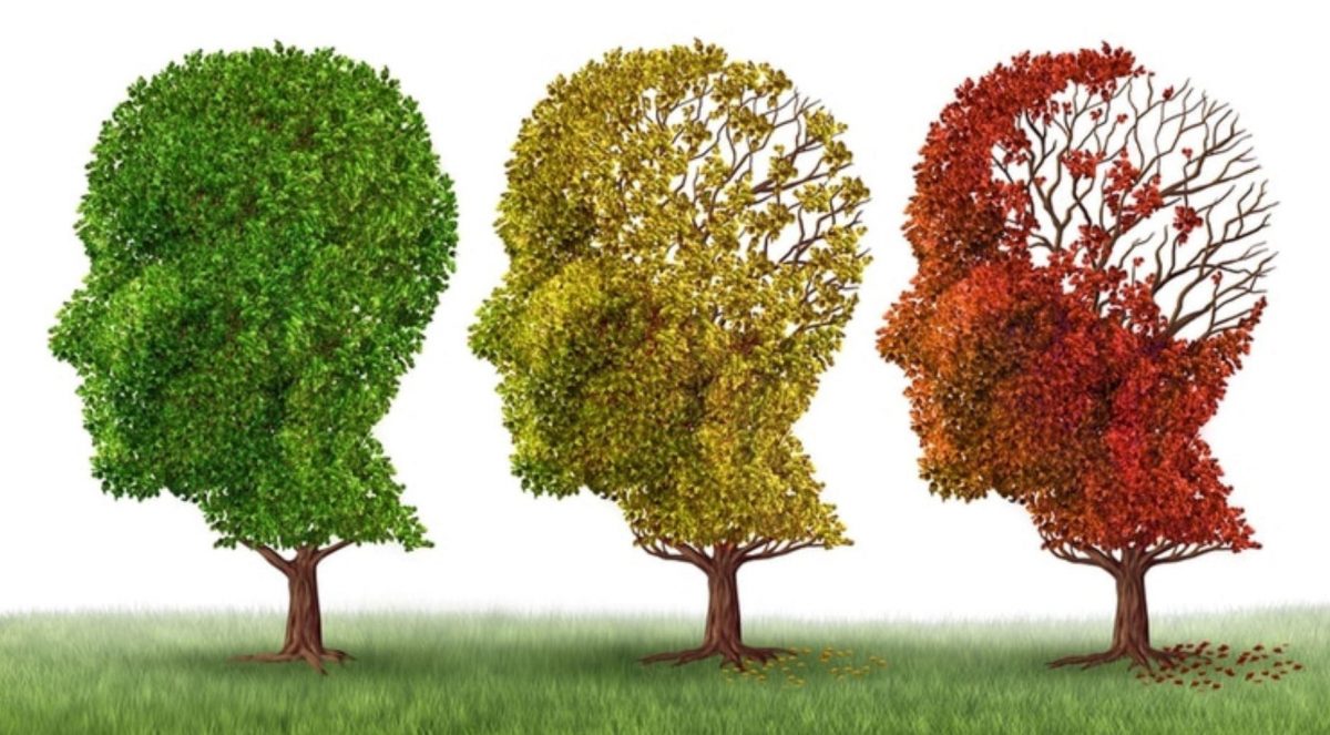 El Alzheimer, la primera causa de demencia en el mundo, afecta a casi 50 millones de personas, y podría llegar a 131 millones en 2050. (Shutterstock)