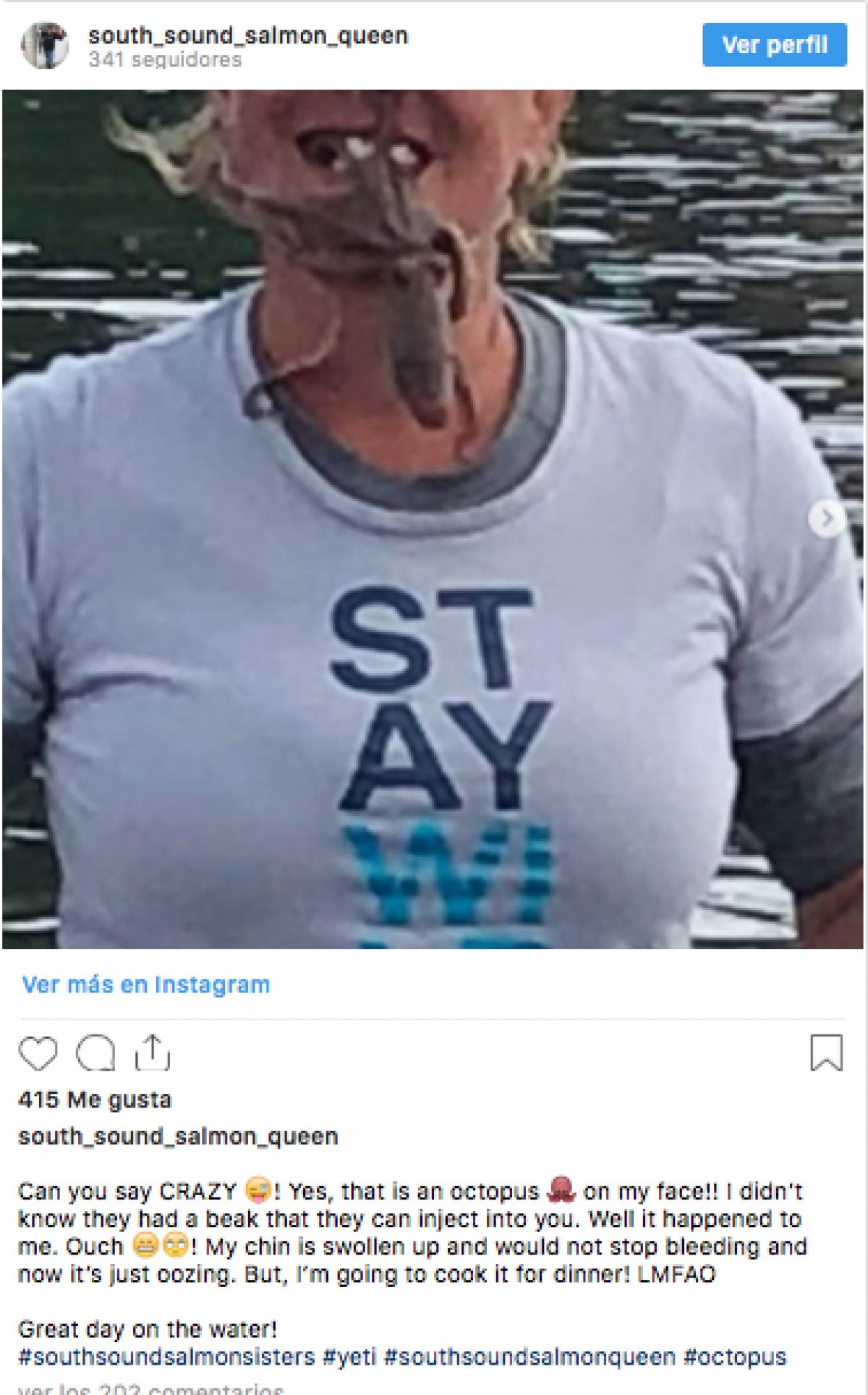 "¿Pueden decirme loca? Sí, es un pulpo en mi cara. No sabía que tenían un pico para inyectarte. Bueno, me pasó a mí. ¡Ouch! Mi mentón está hinchado y no paraba de sangrar. Ahora solo está supurando. ¡Pero voy a cocinarlo para la cena!", escribió Bisceglia en su cuenta de Instagram al compartir las fotografías previas al ataque.