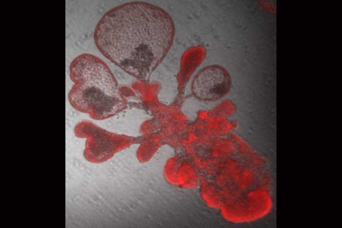 Una célula madre pulmonar se copia a sí misma para generar miles de células y generar una estructura similar a una burbuja que se asemeja a los alvéolos