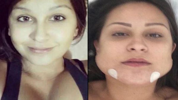 Imagen: Una de las 40 víctimas que padecieron al médico de Goiania, en el centro de Brasil. Imagen: Una de las 40 víctimas que padecieron al médico de Goiania, en el centro de Brasil.