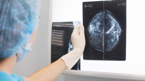 Imagen: Experta analizando un caso de cáncer de mama. Imagen: Experta analizando un caso de cáncer de mama.