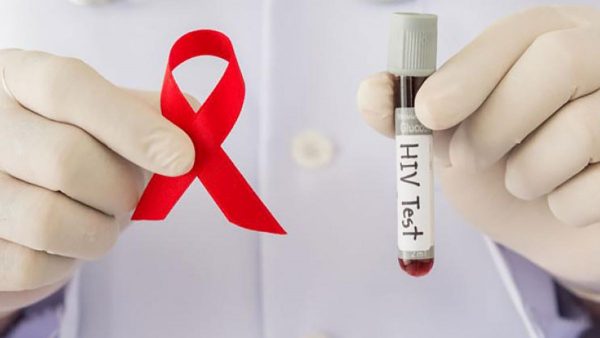 Imagen: Los investigadores aseguran que “son completamente distintos, el virus del VIH es muchísimo más complejo que el SARS-CoV-2” (Getty) Imagen: Los investigadores aseguran que “son completamente distintos, el virus del VIH es muchísimo más complejo que el SARS-CoV-2” (Getty)