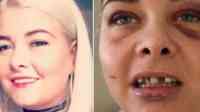 Noticia: Una joven es golpeada por su novio por cambiar su foto de perfil en Facebook Una joven es golpeada por su novio por cambiar su foto de perfil en Facebook