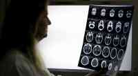 Noticia: Científicos descubren dos 'recetas' para frenar el envejecimiento del cerebro Científicos descubren dos 'recetas' para frenar el envejecimiento del cerebro