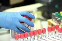 Noticia: Piden $675 millones para acabar con Coronavirus Piden $675 millones para acabar con Coronavirus