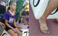 Noticia: Una niña gana tres medallas de oro tras correr sin zapatos Una niña gana tres medallas de oro tras correr sin zapatos