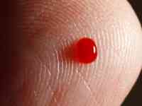 Noticia: Hombre con rara condición llora sangre por una hora Hombre con rara condición llora sangre por una hora