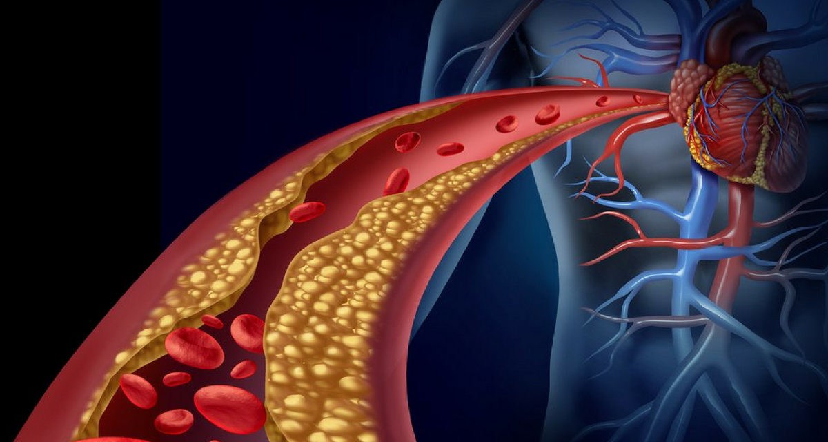 Arterias endurecimiento las en las piernas de