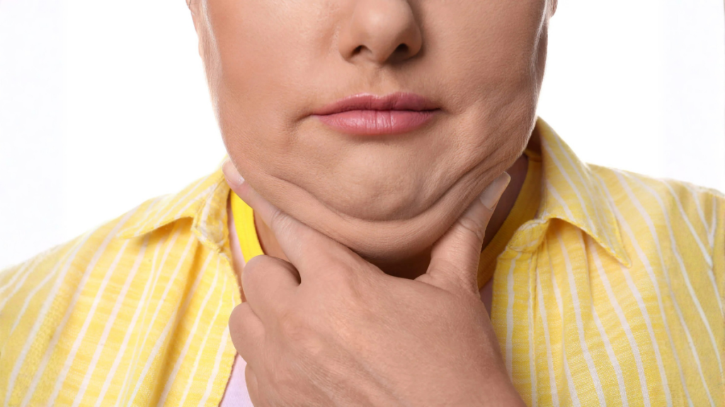 La grasa del cuello puede reducirse de forma natural con hábitos saludables. Expertos explican qué funciona y qué no.