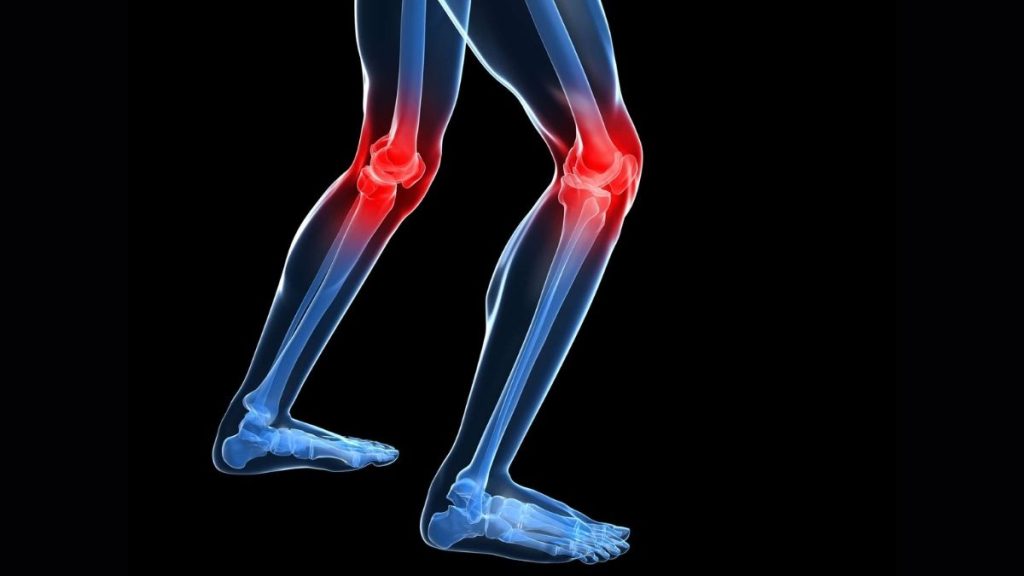 Dolor en las rodillas.